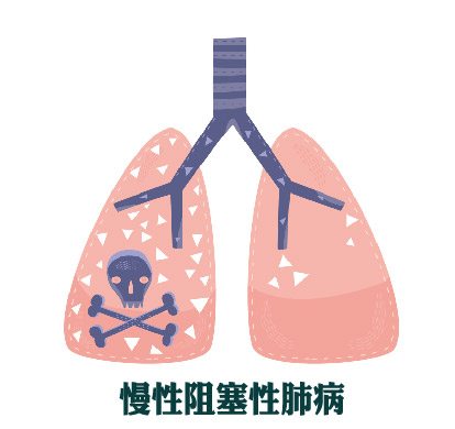 慢性肺炎