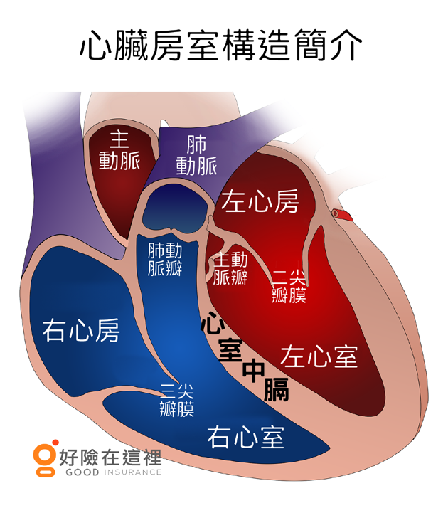 心房中膈缺損手術理賠不合理 保戶能做何主張 Goodins好險在這裡