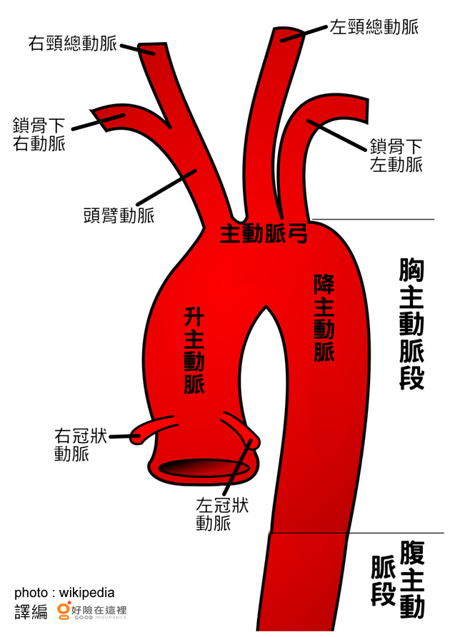 ä¸»å‹•è„ˆå‰é›¢è¦äººå'½ æ